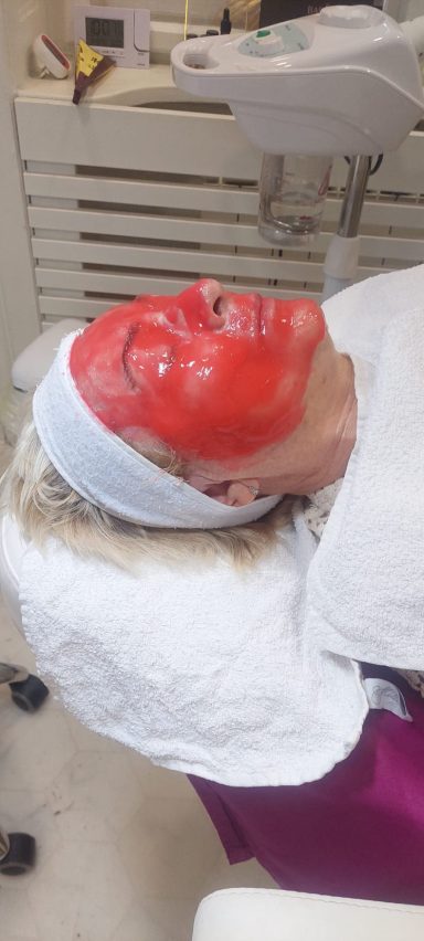 Biološki tretman lica sa Vampire Infusion maskom u salonu Angels Novi Sad