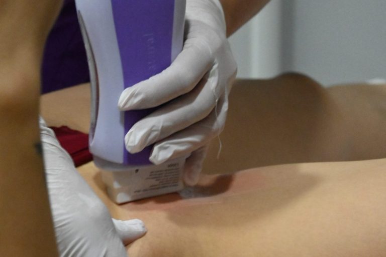 Kozmeticarka epilira klijenta za laserom na stolu