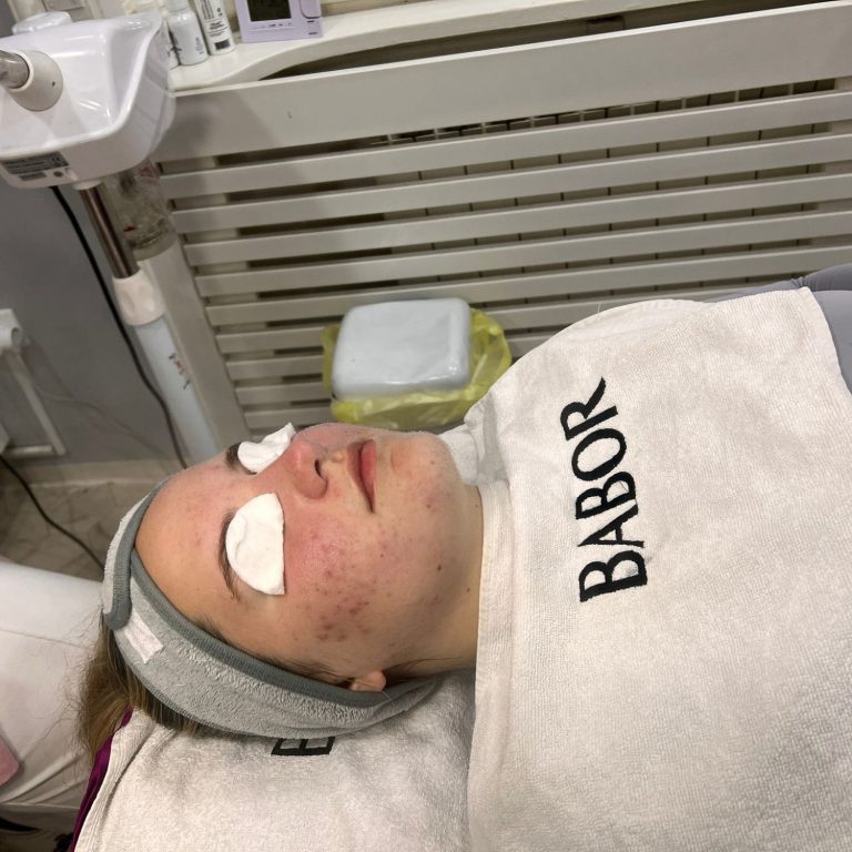 Higijenski tretman lica sa Babor maskom u salonu Angels Novi Sad za dubinsko čišćenje kože
