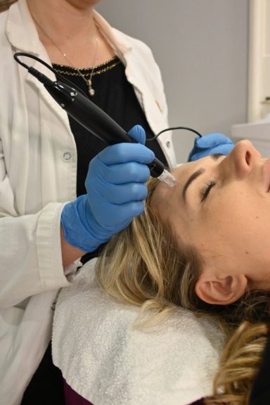 dermapen microneedling u kozmetickom salonu angels novi sad