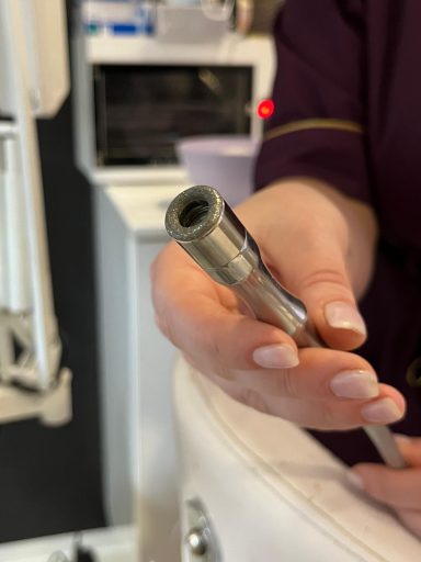Profesionalna mikrodermoabrazija tretman lica u salonu Angels Novi Sad, dijamantska abrazija za dubinsko čišćenje kože i uklanjanje mrtvih ć