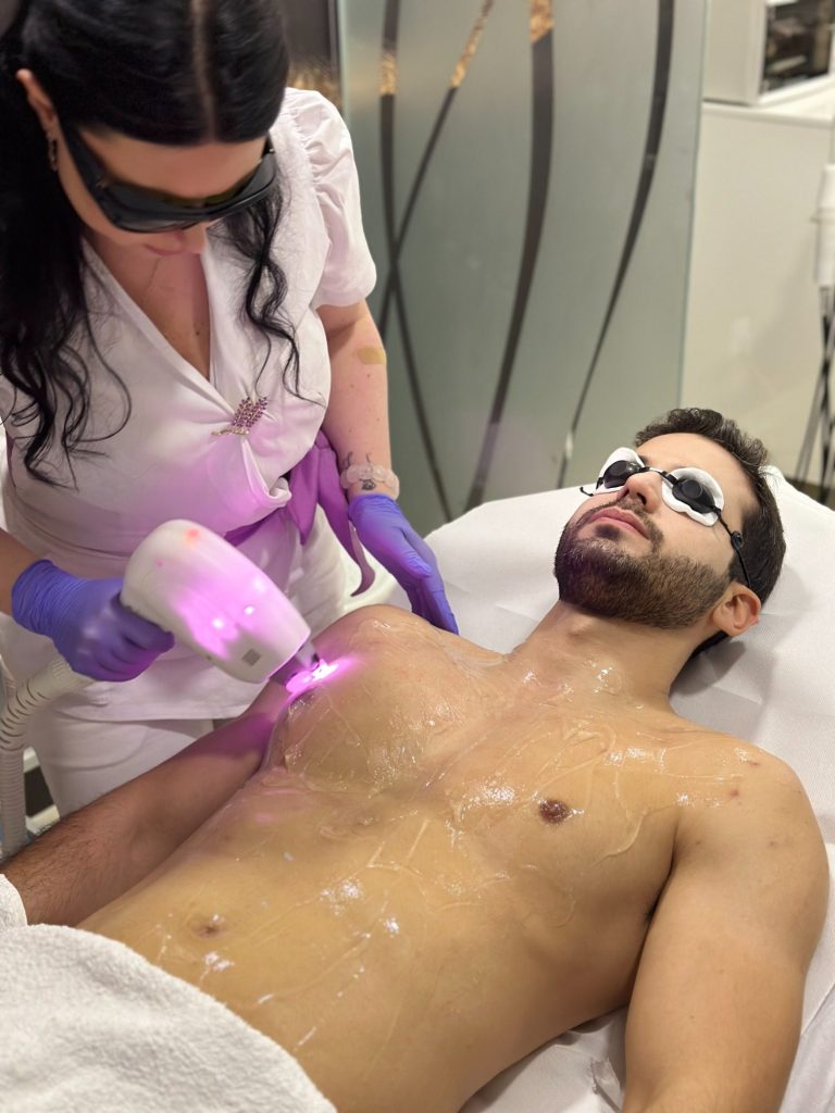 Lasersko uklanjanje dlačica za muškarce epilacija grudi I stomak u kozmetickom salonu