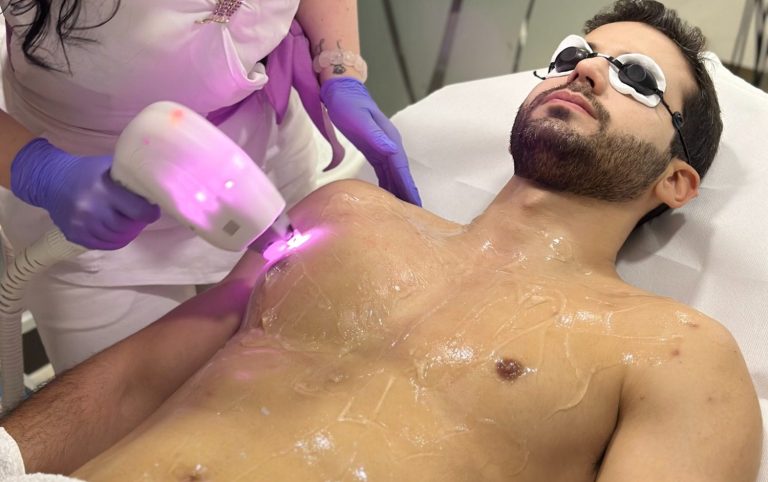 Kozmeticarka epilira klijenta za laserom na stolu