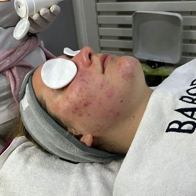 Higijenski tretman lica sa Babor maskom u salonu Angels Novi Sad za dubinsko čišćenje kože