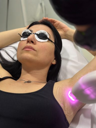 Laserska Epilacija u kozmetickom Salonu angels novi sad