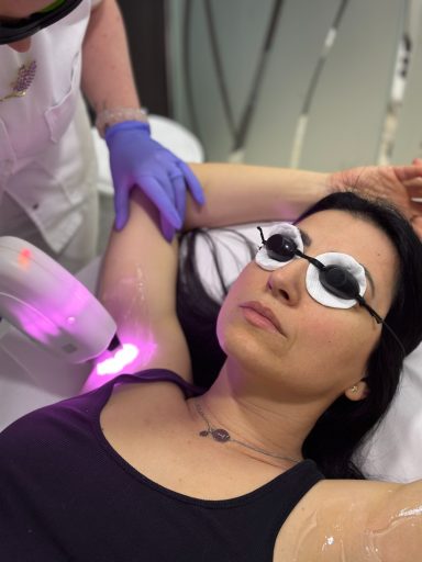 Laserska Epilacija u kozmetickom Salonu angels novi sad