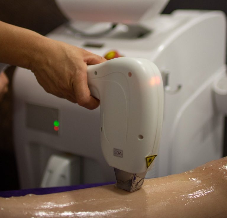 Laserska Epilacija u kozmetickom salonu intimna regija