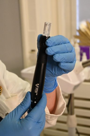 dermapen microneedling u kozmetickom salonu angels novi sad