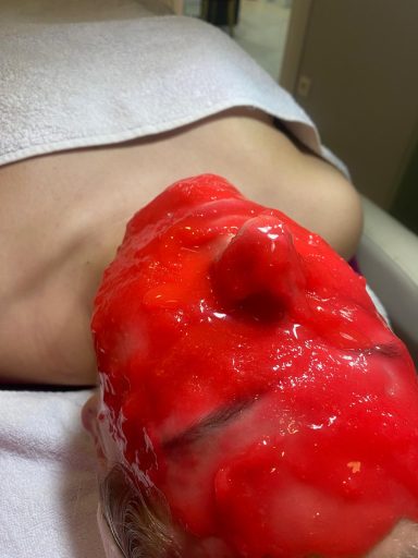 Biološki tretman lica sa Vampire Infusion maskom Novi Sad