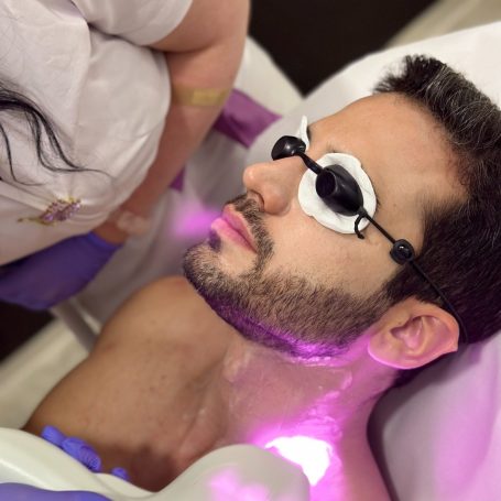 "Već godinama sam bio frustriran zbog nepravilnog rasta dlačica na mom vratu. Nakon mnogih neuspelih pokušaja sa brijanjem i depilacijom, odlučio sam da probam lasersko uklanjanje dlačica. Rezultati su bili neverovatni! Već nakon nekoliko sesija primetio sam značajno smanjenje dlačica, a sada imam potpuno glatku površinu na vratu. Preporučio bih lasersko uklanjanje dlačica svakome ko se bori sa nepravilnim rastom dlačica."