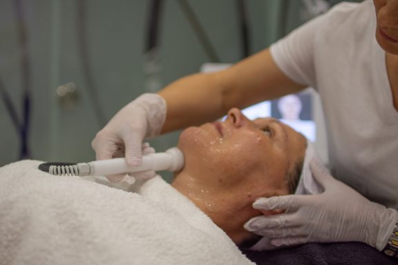 Mezoporacija lica bez igle u salonu Angels Novi Sad