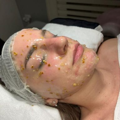 Biološki tretman lica sa Illuminating Orange maskom Novi Sad