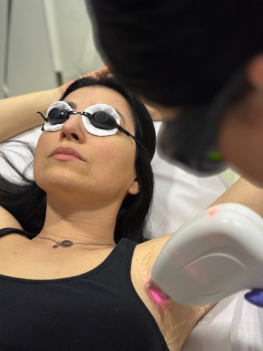 Laserska Epilacija u kozmetickom Salonu angels novi sad
